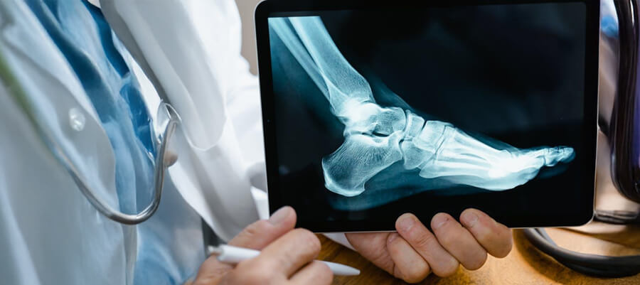 Doctor holding an xray of a foot.
